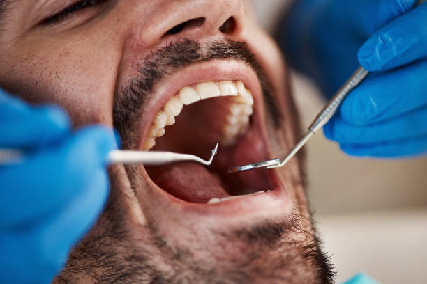 Best Dentist for Dental Trauma  in USA